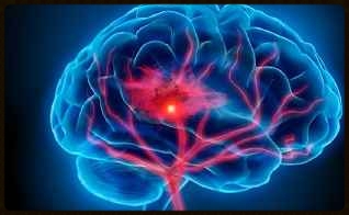 Image Title My Image